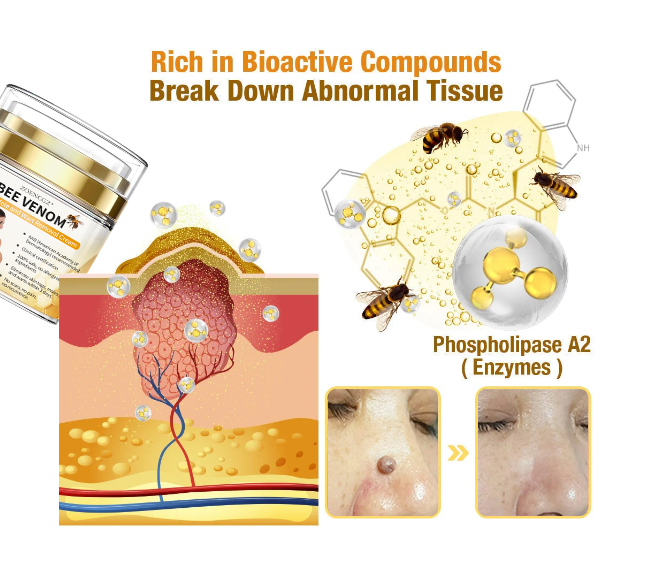 🐝🐝[✨𝐎𝐟𝐟𝐢𝐜𝐢𝐚𝐥 𝐁𝐫𝐚𝐧𝐝 𝐒𝐭𝐨𝐫𝐞✨] 𝐙𝐨𝐞𝐧𝐜𝐠𝐳™™ 𝐁𝐞𝐞 𝐕𝐞𝐧𝐨𝐦 𝐌𝐨𝐥𝐞 𝐚𝐧𝐝 𝐖𝐚𝐫𝐭 𝐓𝐫𝐞𝐚𝐭𝐦𝐞𝐧𝐭 𝐂𝐫𝐞𝐚𝐦(👨‍⚕𝐀𝐀𝐃 𝐑𝐄𝐂𝐎𝐌𝐌𝐄𝐍𝐃𝐒)