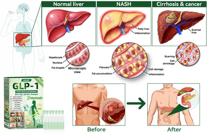 𝑶𝒇𝒇𝒊𝒄𝒊𝒂𝒍 𝑺𝒕𝒐𝒓𝒆 | 𝗛𝗛𝙑𝐵®🌈𝐺𝐿𝑃-𝟏 ALL-𝑰𝑵-𝑶𝑵𝑬 Fit&amp;Vital 𝑶𝒓𝒂𝒍 𝑳𝒊𝒒𝒖𝒊𝒅 (𝐉𝐮𝐬𝐭 𝐨𝐧𝐜𝐞 𝐚 𝐝𝐚𝐲, 𝐯𝐢𝐬𝐢𝐛𝐥𝐞 𝐜𝐡𝐚𝐧𝐠𝐞𝐬 𝐢𝐧 𝟕 𝐝𝐚𝐲𝐬）✅ 𝐅𝐨𝐫 𝐨𝐛𝐞𝐬𝐢𝐭𝐲, 𝐜𝐚𝐫𝐝𝐢𝐨𝐯𝐚𝐬𝐜𝐮𝐥𝐚𝐫 𝐡𝐞𝐚𝐥𝐭𝐡, 𝐝𝐢𝐚𝐛𝐞𝐭𝐞𝐬, 𝐬𝐥𝐞𝐞𝐩 𝐚𝐩𝐧𝐞𝐚, 𝐆𝐮𝐭 𝐇𝐞𝐚𝐥𝐭𝐡, 𝐣𝐨𝐢𝐧𝐭 𝐢𝐬𝐬𝐮𝐞𝐬, 𝐚𝐧𝐝 𝐦𝐨𝐫𝐞