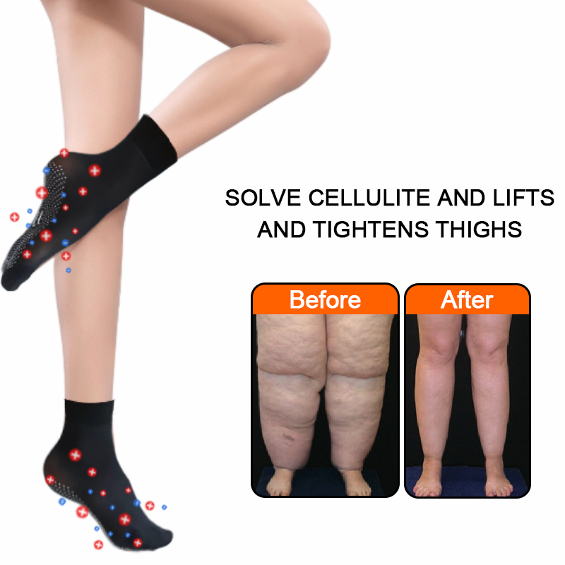🇺🇲𝑶𝒇𝒇𝒊𝒄𝒊𝒂𝒍 𝑺𝒕𝒐𝒓𝒆 |🔥🦵FROCCHAR® Tourmaline Slimming & Varicose Veins & Detoxification Stretch Socks （Results in 7 days）✅For obesity,Joint pain, lymph nodes, varicose veinsas, and more